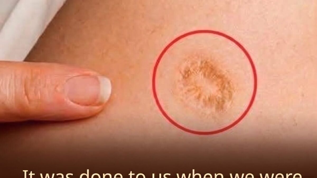 the small round scar on your upper arm has a remarkable story
